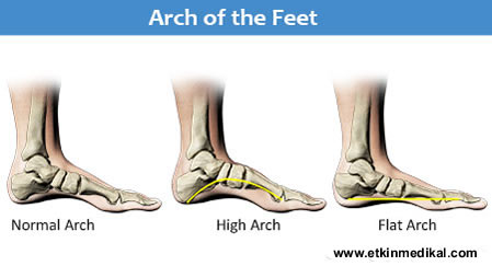 arch support for flat feet in high heels