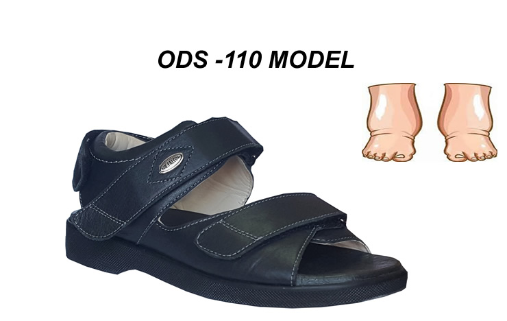 wide sandals for swollen feet