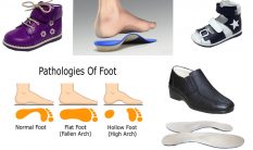 Flat Foot & High Arch Shoes