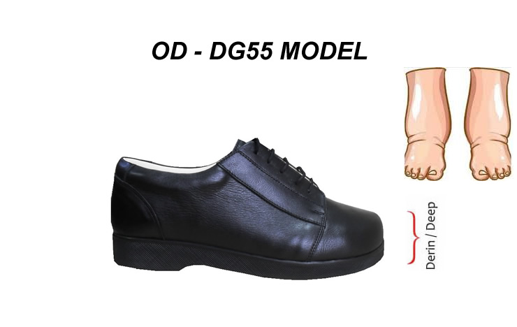 Best Specialist Shoes for Diabetes Swollen Feet OD-DG55