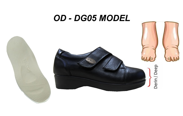 Sürekli Şiş Ayaklar İçin Diyabet Ayakkabısı OD-DG05