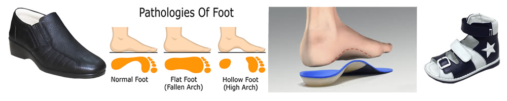 Flat foot shoes