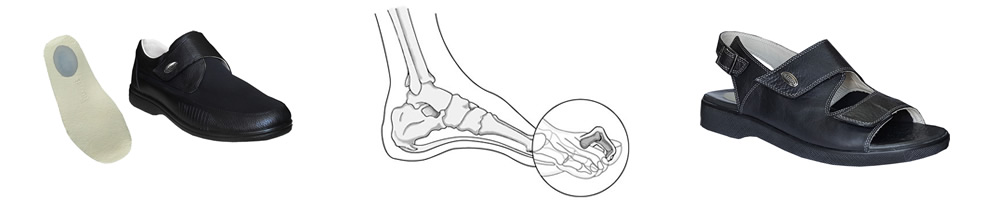 Men's shoes models for bunions