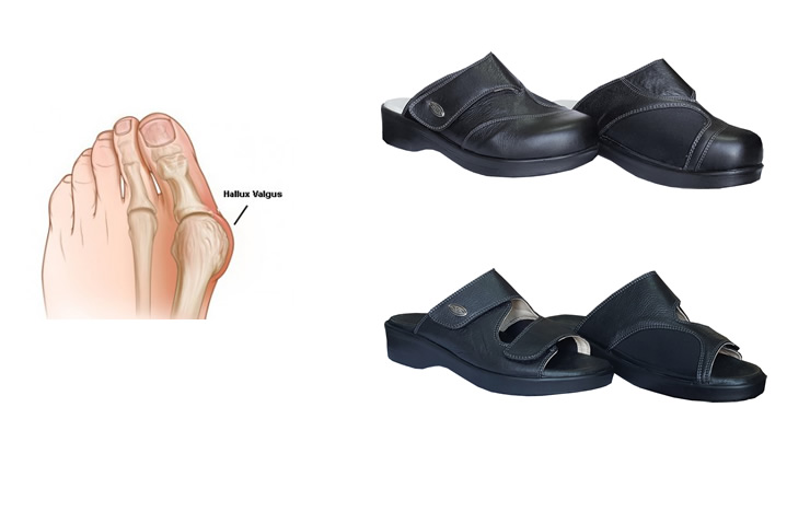 Womens Slippers for Bunions