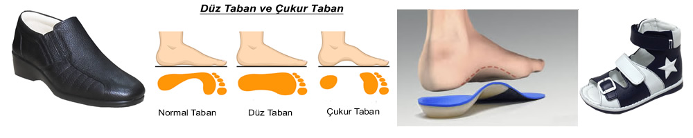 Düz ve Çukur Taban Ayakkabı