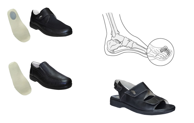 Erkek Ortopedik halluks valgus ayakkabilari