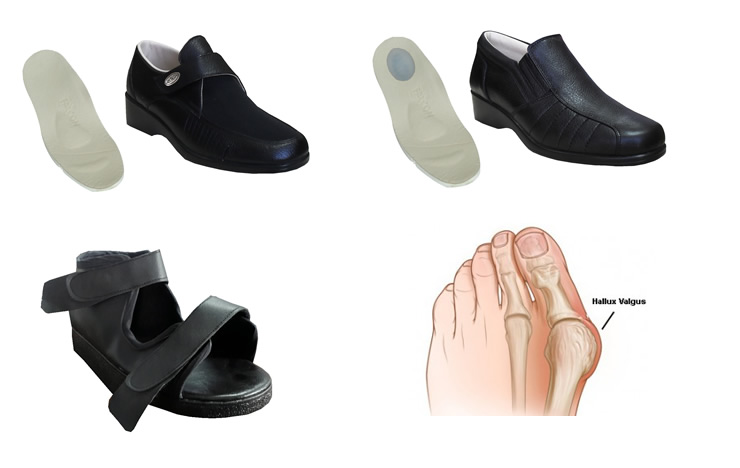 Halluks Valgus Ayakkabilari Bayan Modeller